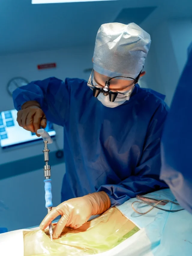 Joint Replacement Surgeries